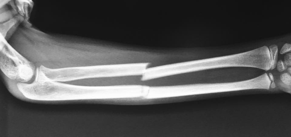 Fracture & Trauma Management