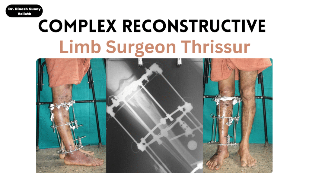 complex reconstructive limb surgeon Thrissur
