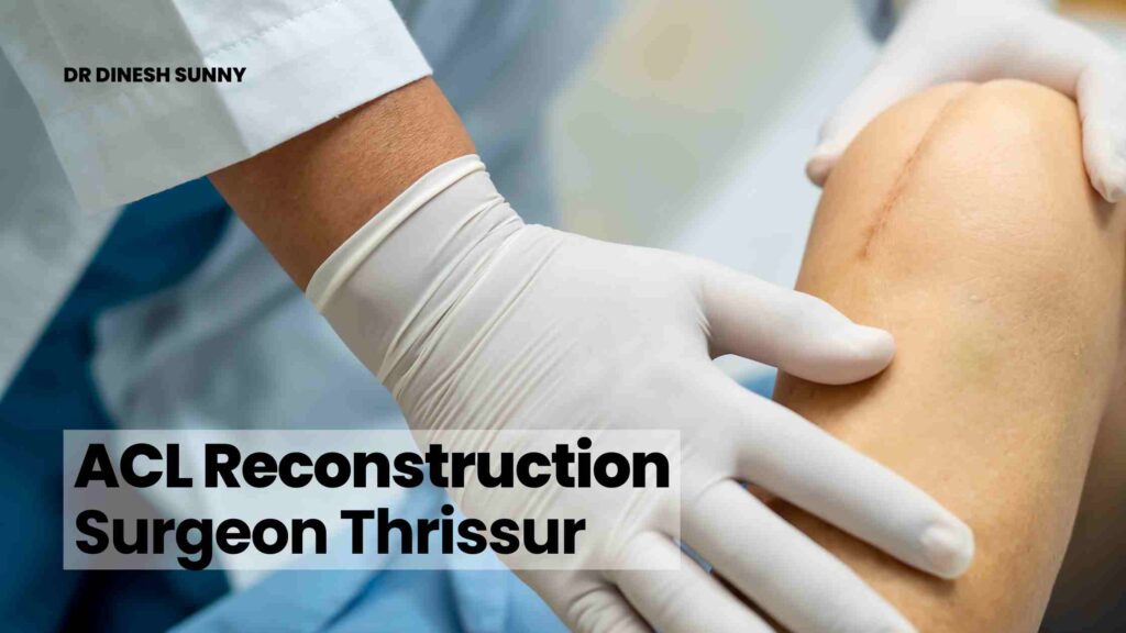 ACL reconstruction surgeon Thrissur
