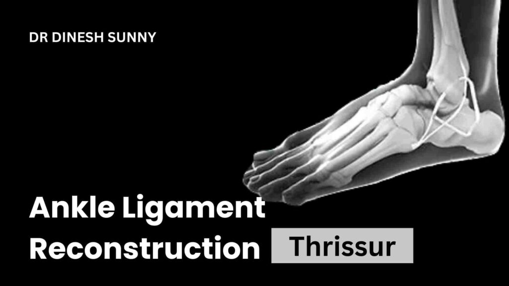Ankle ligament reconstruction Thrissur