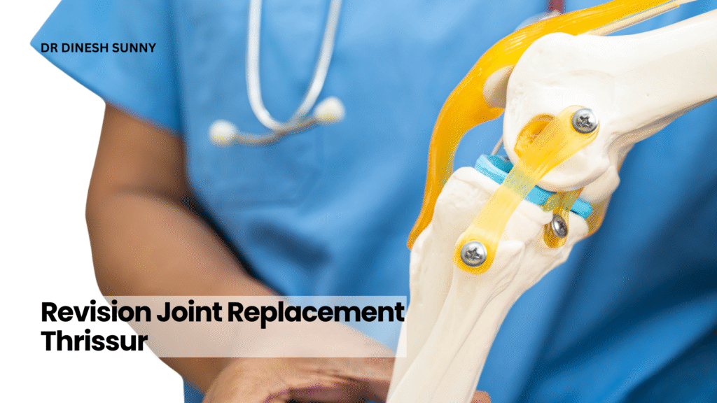 Revision joint replacement Thrissur