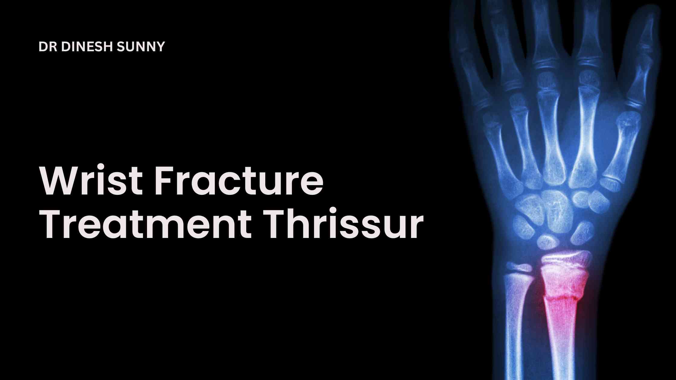Wrist fracture treatment Thrissur