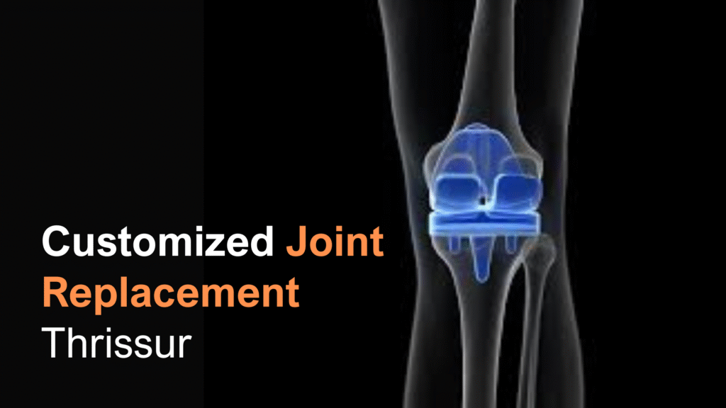 customized joint replacement Thrissur
